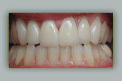 image-2, pictures periodontal disease