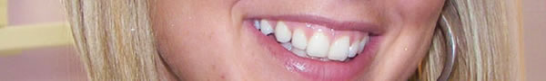 healthy smile with whitened teeth